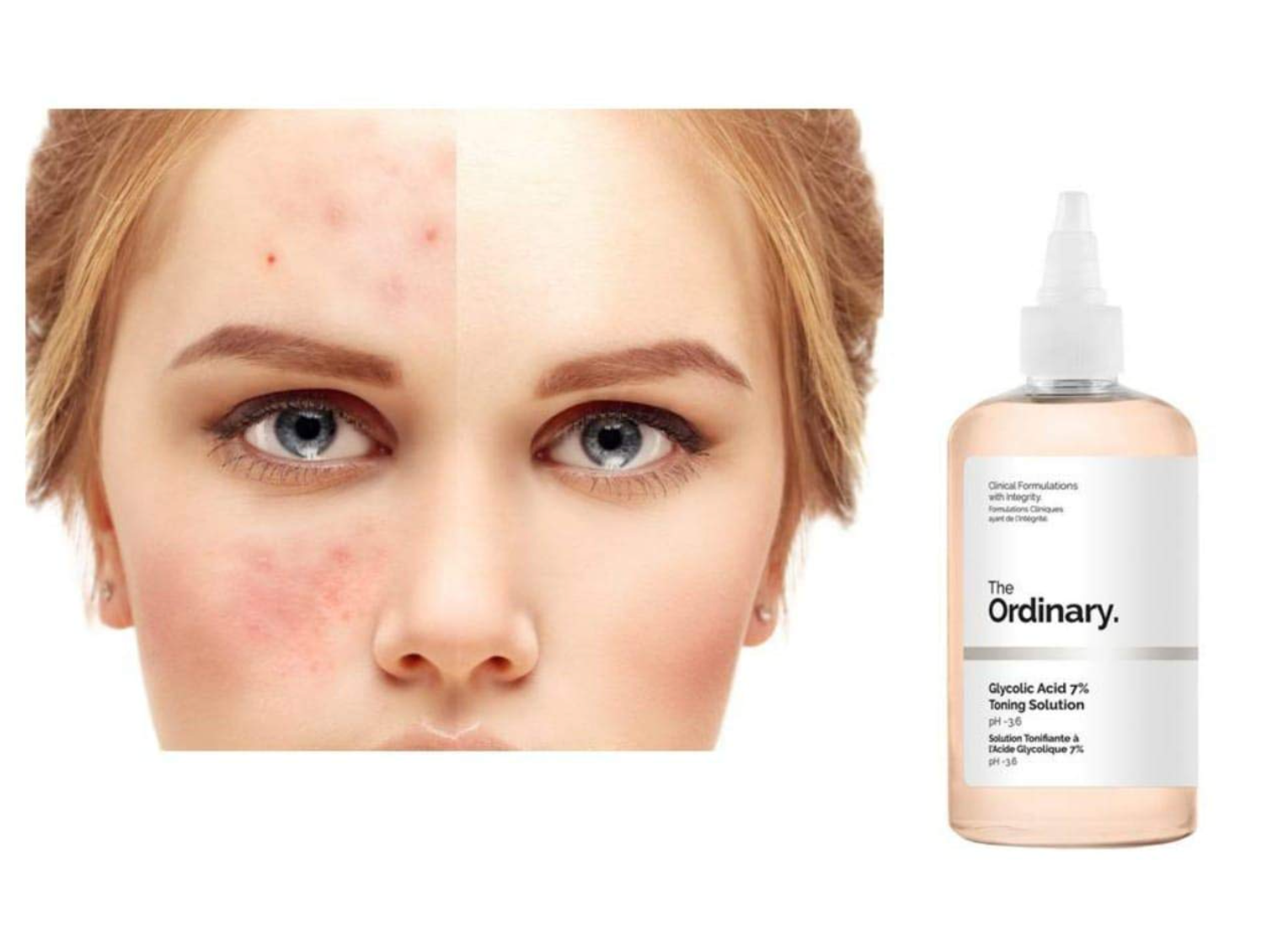 The Ordinary Glycolic Acid 7% Toning Solution 240ml – Yes You Online
