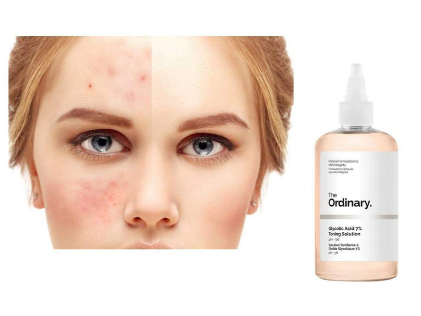 The Ordinary Glycolic Acid 7% Toning Solution 240ml